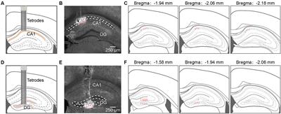 Electrophysiological activity pattern of mouse hippocampal CA1 and dentate gyrus under isoflurane anesthesia